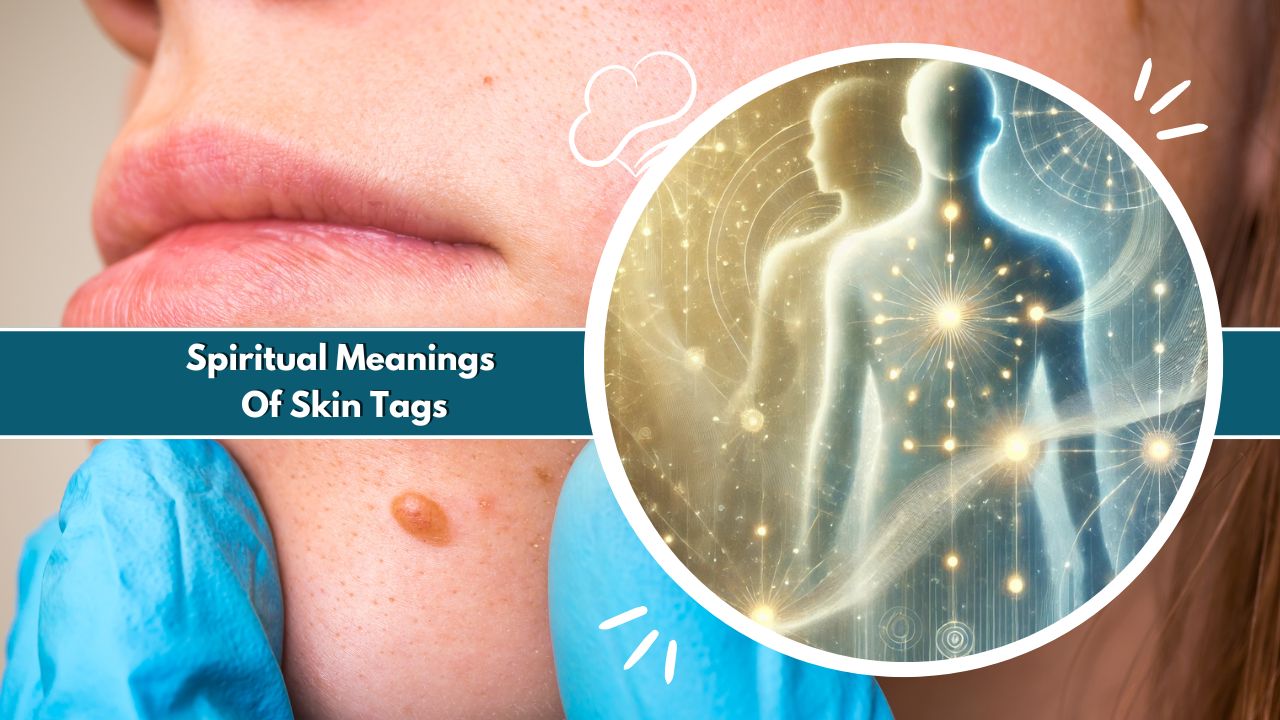 Spiritual Meanings Of Skin Tags